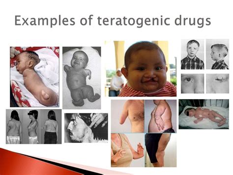 teratogel|teratogen deutsch.